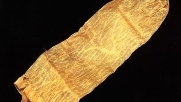 Histoire de la contraception